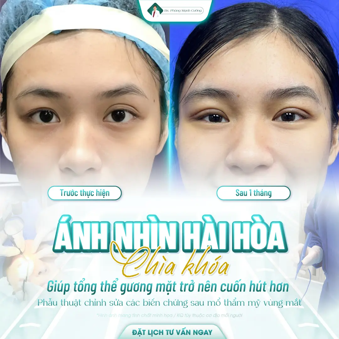 Giá cắt mắt 2 mí hiện nay tại các cơ sở thẩm mỹ uy tín dao động từ 7 đến 20 triệu đồng