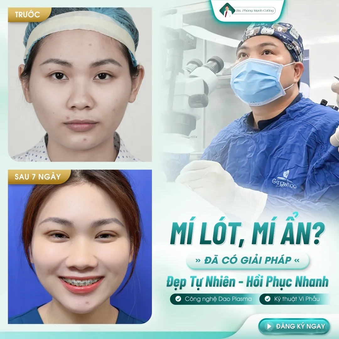 Tiêu chí đánh giá địa chỉ cắt mí ở Quy Nhơn uy tín