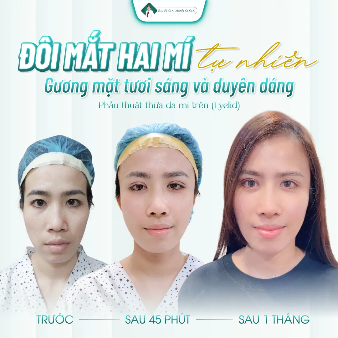 Bác sĩ Phùng Mạnh Cường - chuyên gia với hơn 15 năm kinh nghiệm