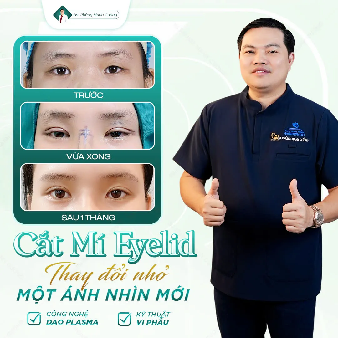 Tay nghề của bác sĩ là yếu tố tiên quyết khi lựa chọn địa chỉ cắt mí ở Vinh
