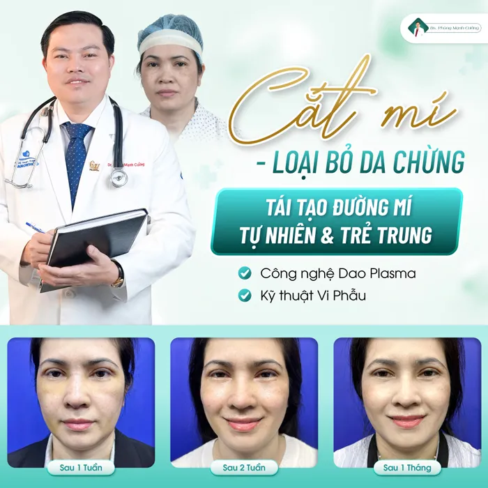 Cánh Tay Robot – Vũ Khí Hiện Đại Đưa Nền Thẩm Mỹ Lên Tầm Cao Mới