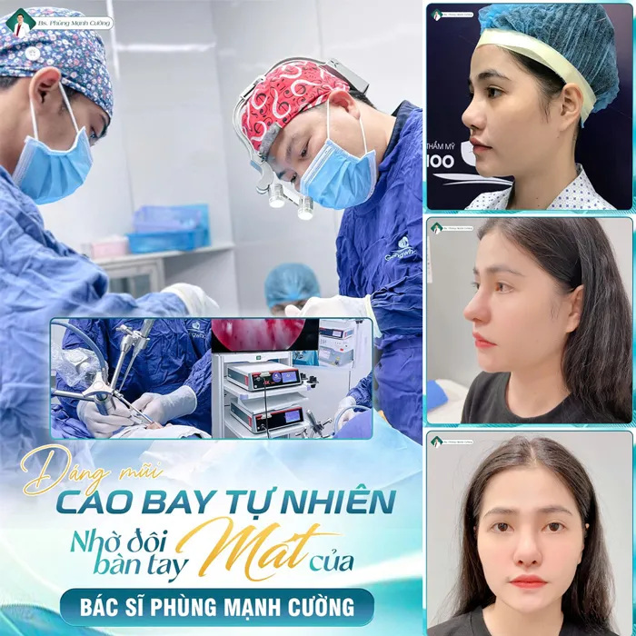 Cánh Tay Robot – Vũ Khí Hiện Đại Đưa Nền Thẩm Mỹ Lên Tầm Cao Mới