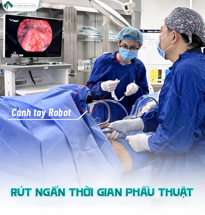 Cánh Tay Robot – Vũ Khí Hiện Đại Đưa Nền Thẩm Mỹ Lên Tầm Cao Mới