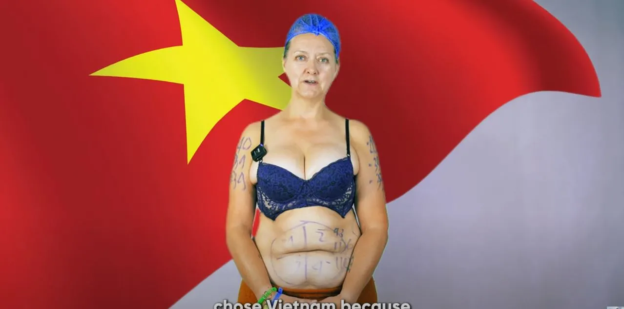 “Ưu Đãi 50%” Lipo Ultrasound Vắt Kiệt Mỡ Thừa 1 Lần Duy Nhất