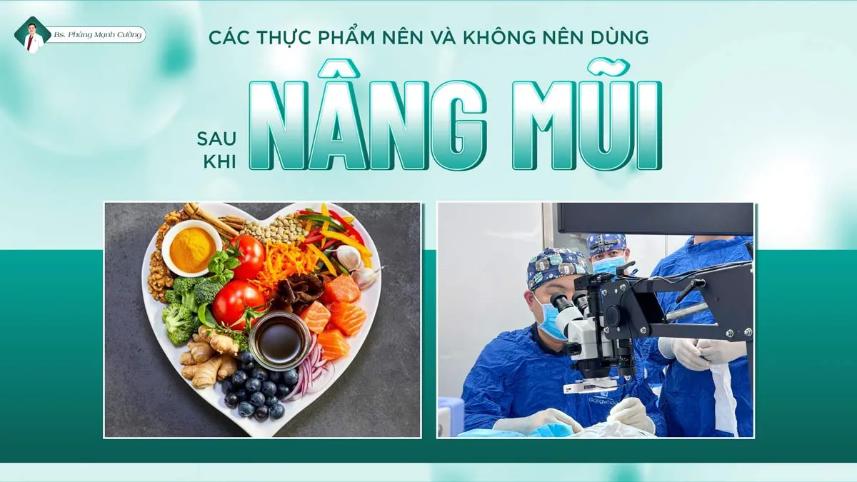 Những thực phẩm nên và không nên ăn sau nâng mũi