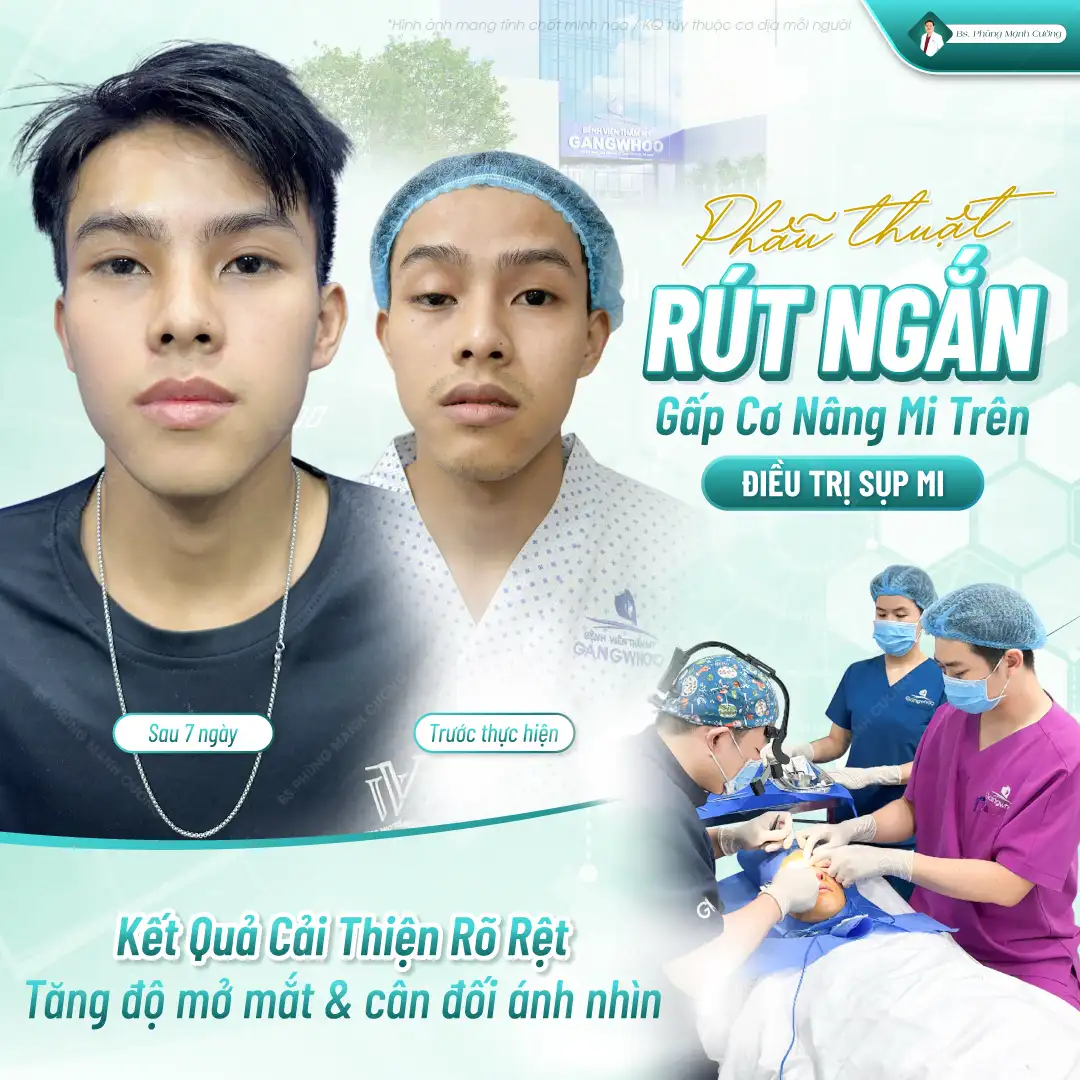 Tiêu chí đánh giá địa chỉ cắt mí uy tín tại Biên Hòa