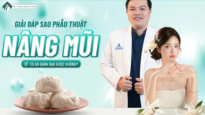 Nâng mũi ăn bánh bao được không? Cần lưu ý những gì?