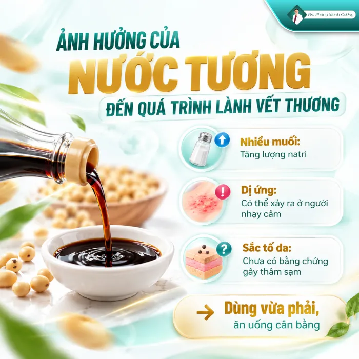 Nâng mũi ăn nước tương được không 6 Nâng mũi ăn nước tương được không