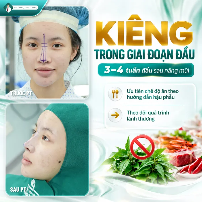 Nâng mũi ăn rau răm được không
