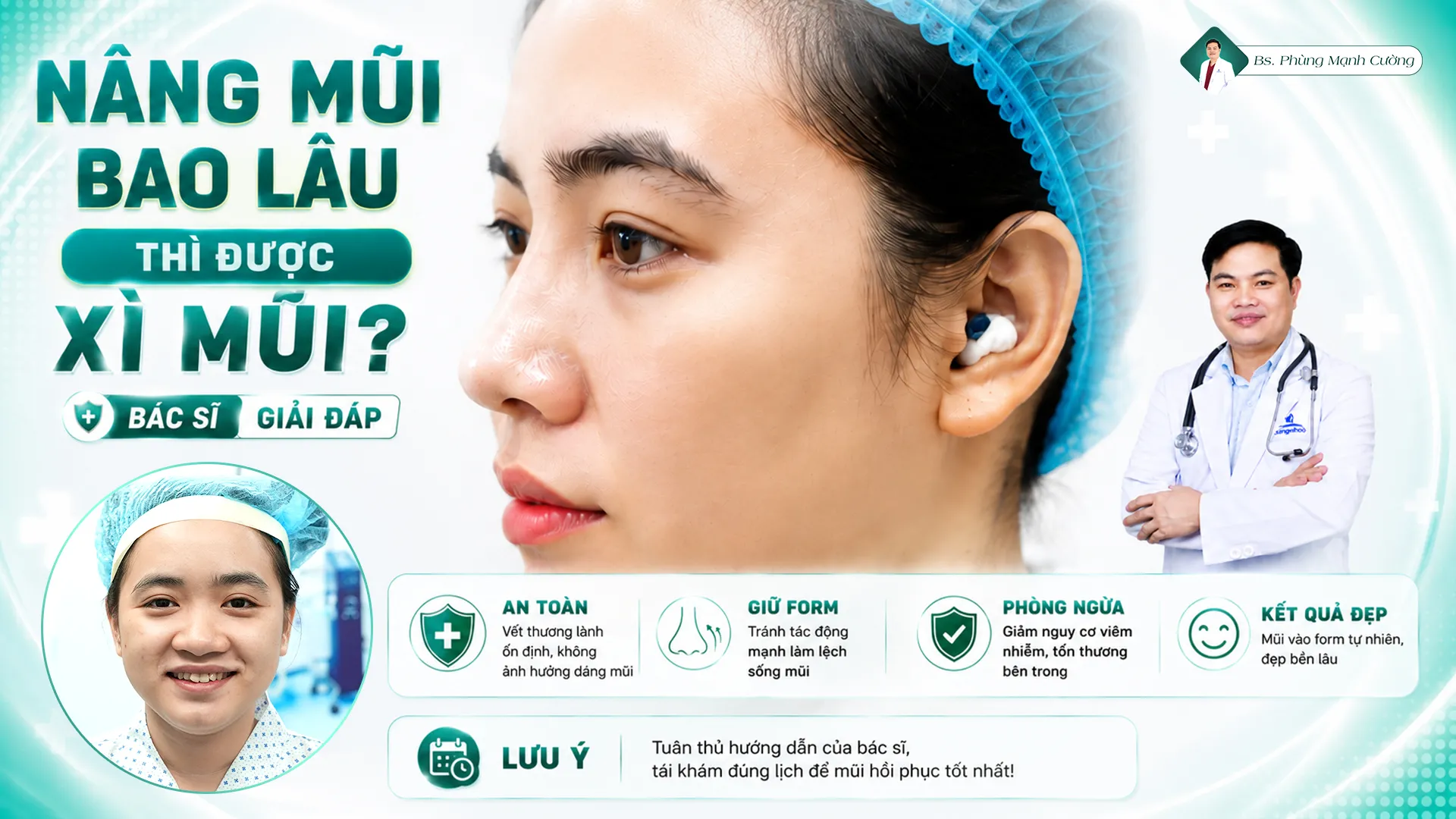 Nâng mũi bao lâu thì được xì mũi? Bác sĩ giải đáp