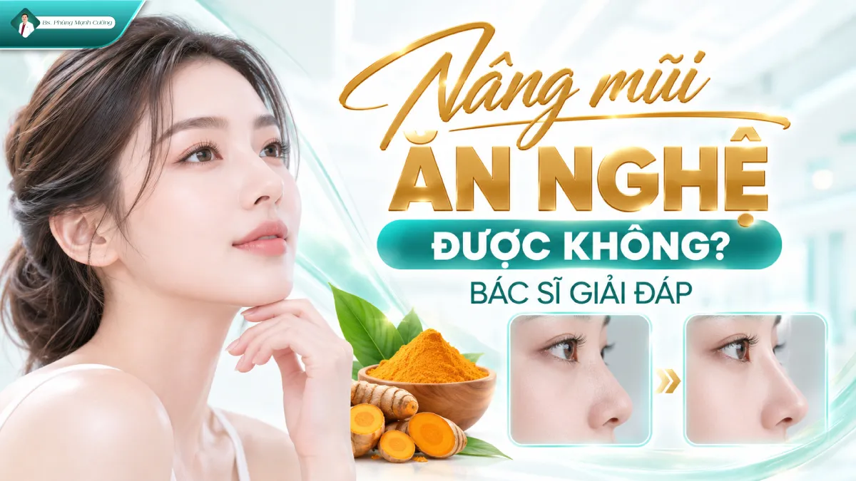 Nâng mũi ăn nghệ được không? Bác sĩ giải đáp