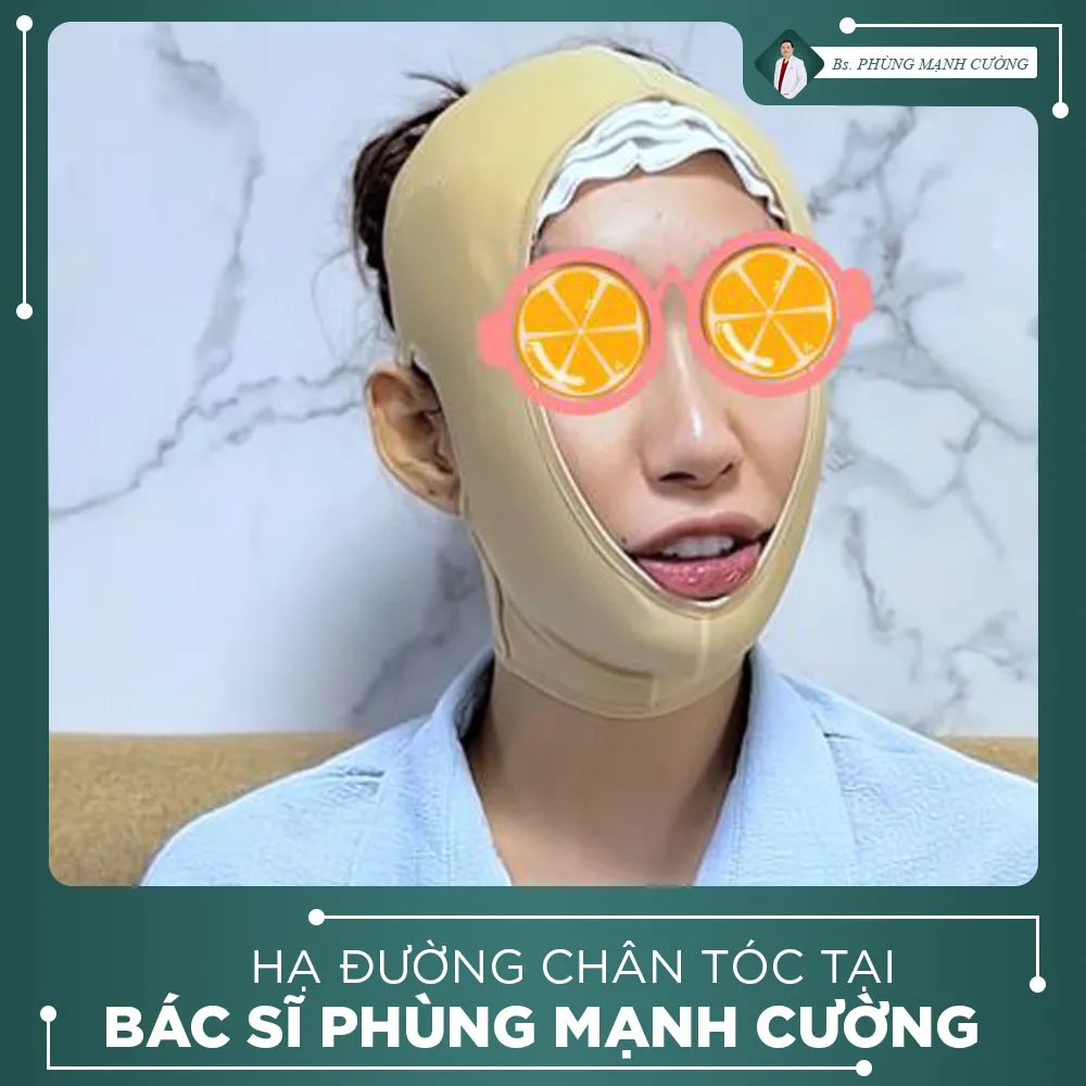 Video Khách Hàng Hạ Đường Chân Tóc Tại Bs Phùng Mạnh Cường