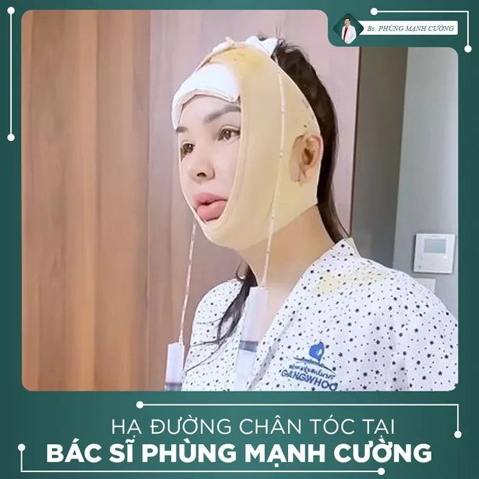 Video Khách Hàng Hạ Đường Chân Tóc Tại Bs Phùng Mạnh Cường