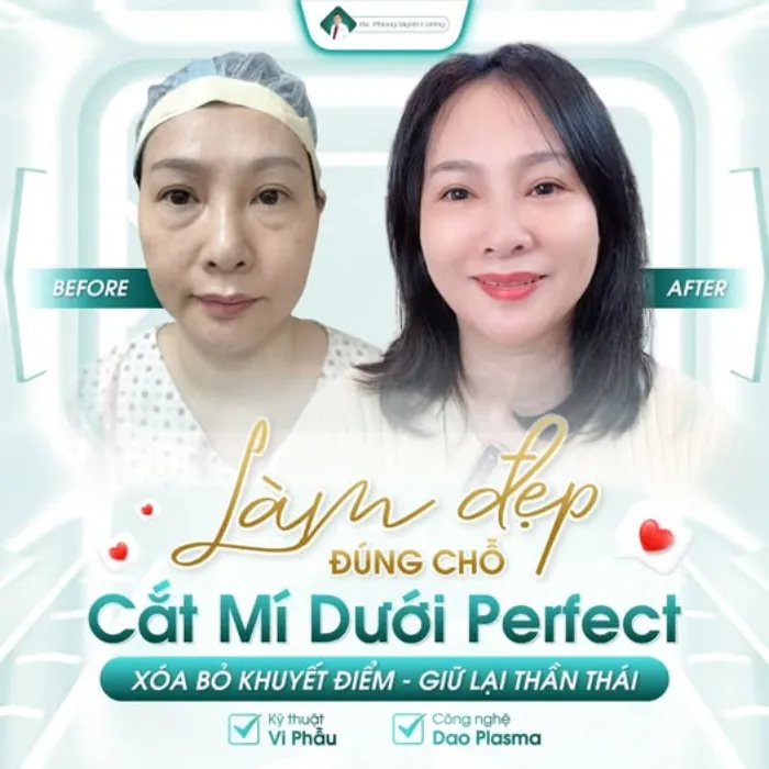 Người lớn tuổi có nên cắt mí mắt không? Những yếu tố cần cân nhắc trước khi cắt mí 7 Người lớn tuổi có nên cắt mí mắt không? Những yếu tố cần cân nhắc trước khi cắt mí