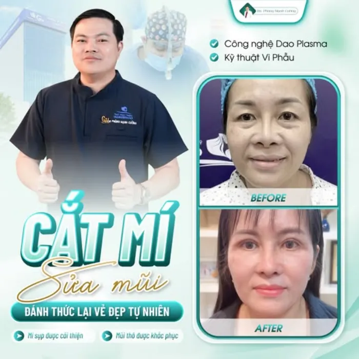 Người lớn tuổi có nên cắt mí mắt không? Những yếu tố cần cân nhắc trước khi cắt mí 8 Người lớn tuổi có nên cắt mí mắt không? Những yếu tố cần cân nhắc trước khi cắt mí