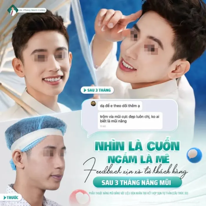 Nâng mũi bị ngứa: Nguyên nhân và cách xử lý 6 Nâng mũi bị ngứa: Nguyên nhân và cách xử lý