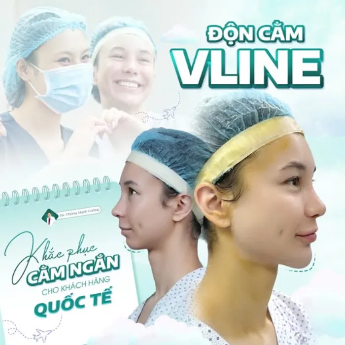 Giải Mã Xu Hướng Gọt Cằm V-line: Đẹp Tự Nhiên, An Toàn Tối Đa