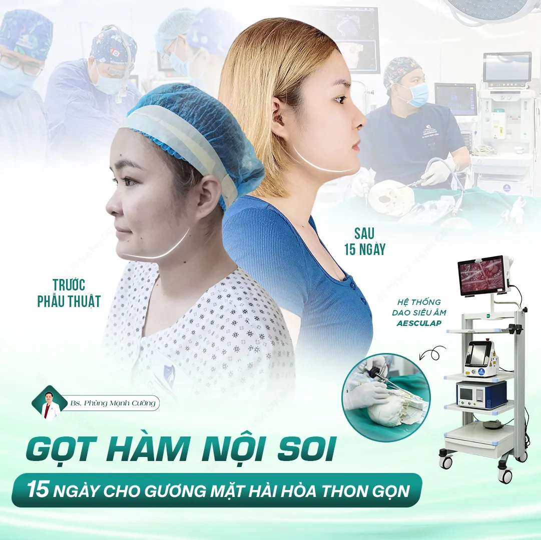 Hình Ảnh, Video Khách Hang Gọt Mặt Tại Bs Phùng Mạnh Cường