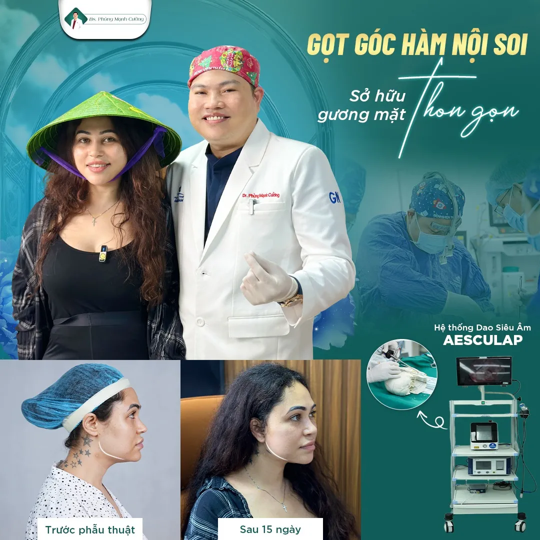 Hình Ảnh, Video Khách Hang Gọt Mặt Tại Bs Phùng Mạnh Cường