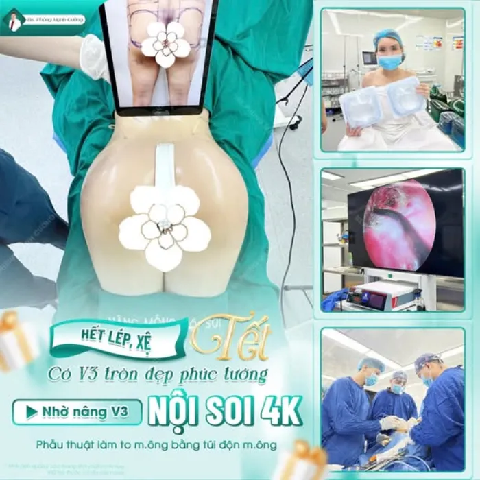 Nâng Mông Sebbin: Bí Quyết Sở Hữu Vòng 3 Hoàn Hảo Tại Bác Sĩ Phùng Mạnh Cường