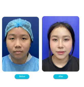 Bác Sĩ Phùng Mạnh Cường Chuyên Khoa Phẫu Thuật Thẩm Mỹ