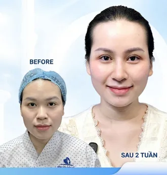 Bác Sĩ Phùng Mạnh Cường Chuyên Khoa Phẫu Thuật Thẩm Mỹ