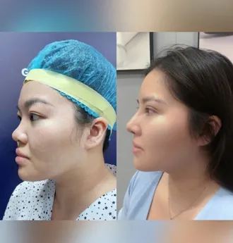 Bác Sĩ Phùng Mạnh Cường Chuyên Khoa Phẫu Thuật Thẩm Mỹ