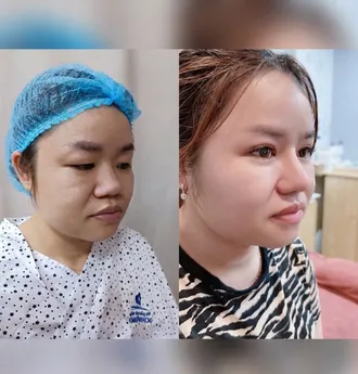 Bác Sĩ Phùng Mạnh Cường Chuyên Khoa Phẫu Thuật Thẩm Mỹ