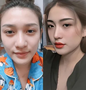 Bác Sĩ Phùng Mạnh Cường Chuyên Khoa Phẫu Thuật Thẩm Mỹ