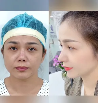 Bác Sĩ Phùng Mạnh Cường Chuyên Khoa Phẫu Thuật Thẩm Mỹ