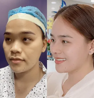 Bác Sĩ Phùng Mạnh Cường Chuyên Khoa Phẫu Thuật Thẩm Mỹ