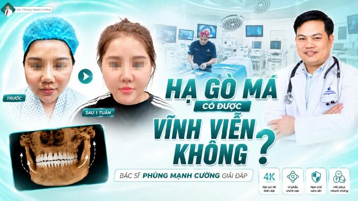 Hạ Gò Má Có Được Vĩnh Viễn Không? Bác Sĩ Phùng Mạnh Cường Giải Đáp