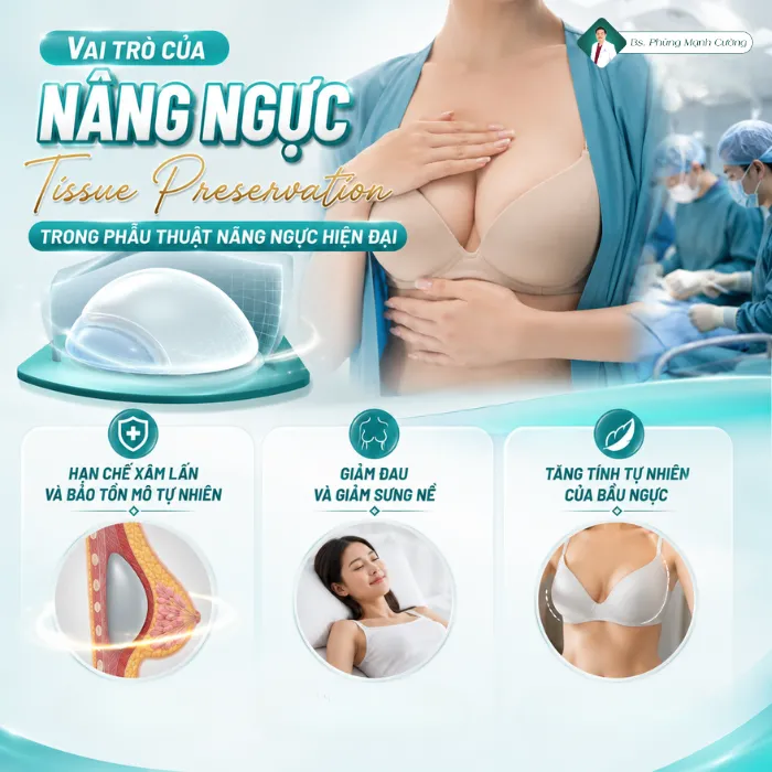 Nâng Ngực Tissue Preservation Là Gì? Kỹ Thuật Bảo Tồn Mô Hạn Chế Xâm Lấn 8 Nâng Ngực Tissue Preservation Là Gì? Kỹ Thuật Bảo Tồn Mô Hạn Chế Xâm Lấn