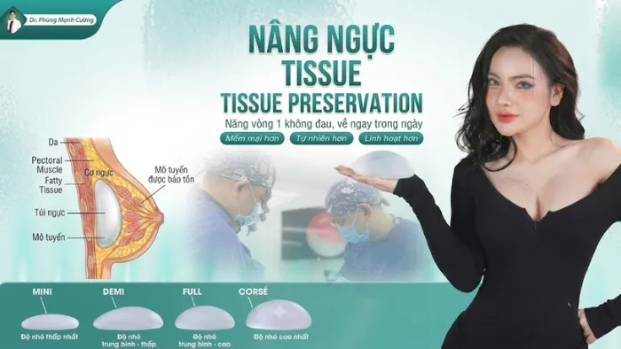 Nâng Ngực Tissue Preservation Là Gì? Kỹ Thuật Bảo Tồn Mô Hạn Chế Xâm Lấn 