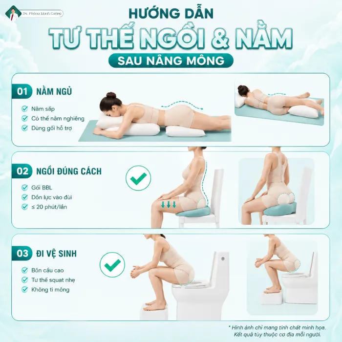 Nâng Mông Bao Lâu Thì Ngồi Được? Hướng Dẫn Chăm Sóc