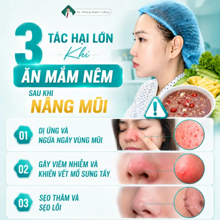 Nâng Mũi Ăn Mắm Nêm Được Không? Kiêng Trong Bao Lâu?