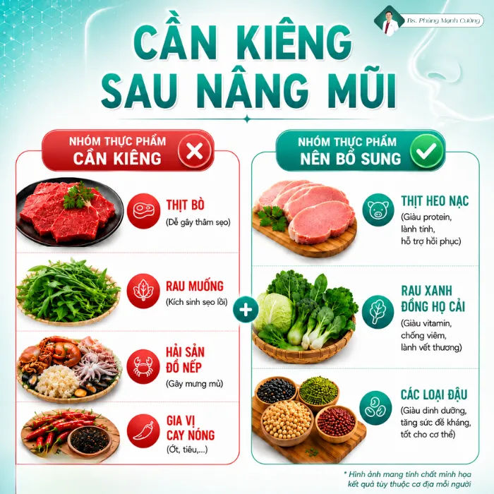 Nâng Mũi Ăn Mắm Nêm Được Không? Kiêng Trong Bao Lâu?