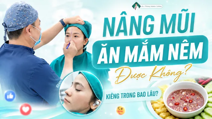 Nâng Mũi Ăn Mắm Nêm Được Không? Kiêng Trong Bao Lâu?
