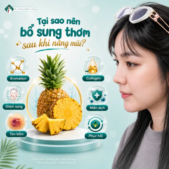 Nâng Mũi Ăn Thơm (Dứa) Được Không? Bác Sĩ Cường Giải Đáp