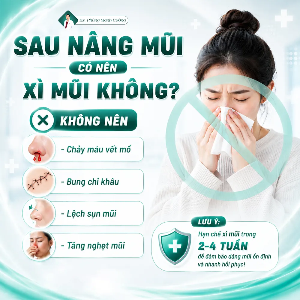 Nâng mũi bao lâu thì được xì mũi? Bác sĩ giải đáp
