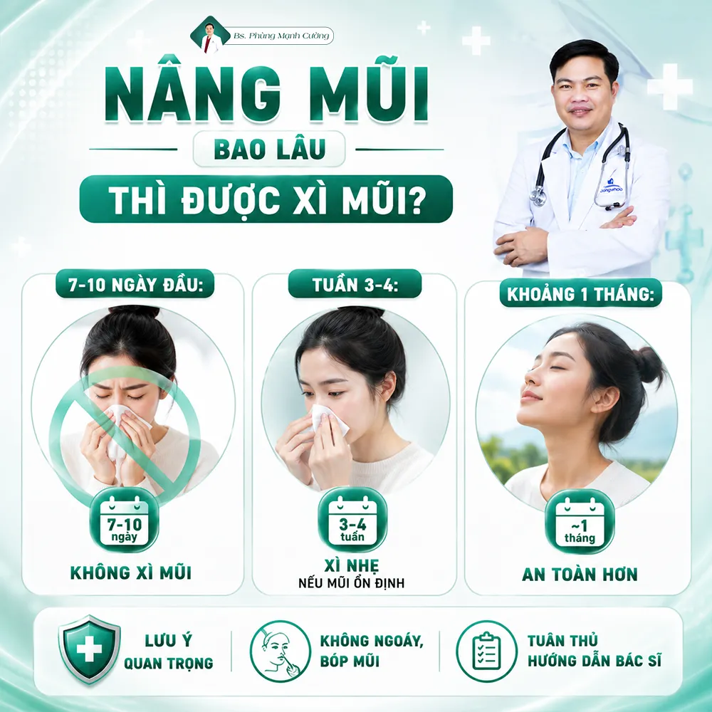 Nâng mũi bao lâu thì được xì mũi? Bác sĩ giải đáp
