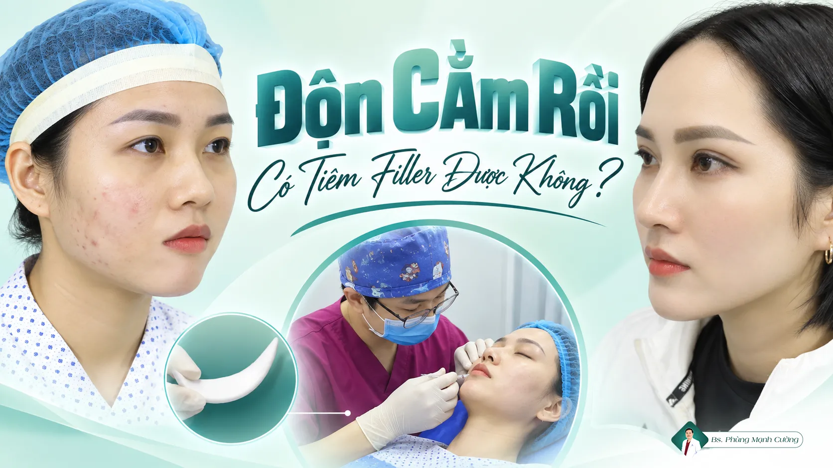 Độn Cằm Rồi Có Tiêm Filler Được Không?