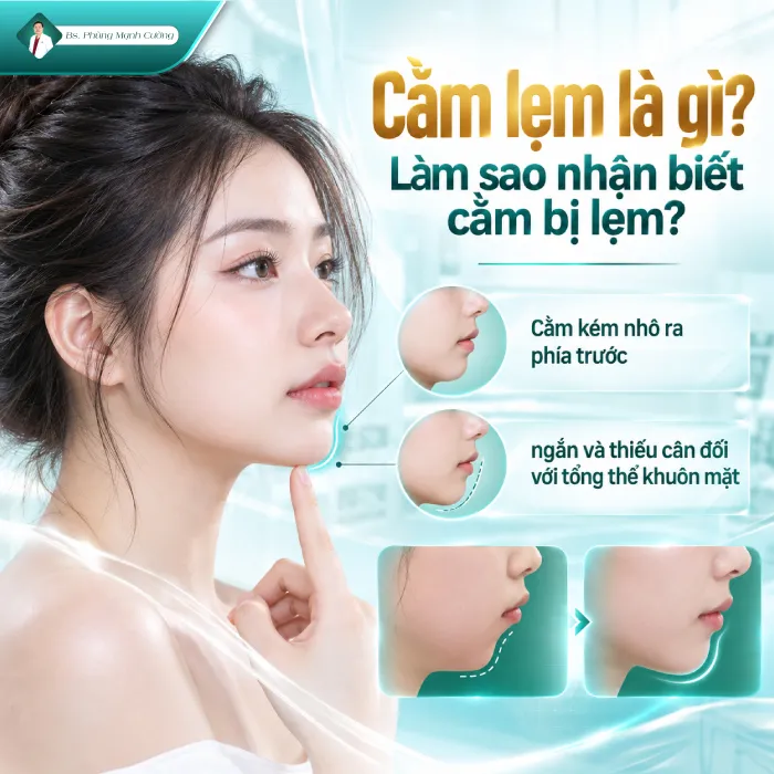 Độn Cằm Lẹm: Nguyên Nhân, Phương Pháp Khắc Phục Và Những Điều Cần Biết