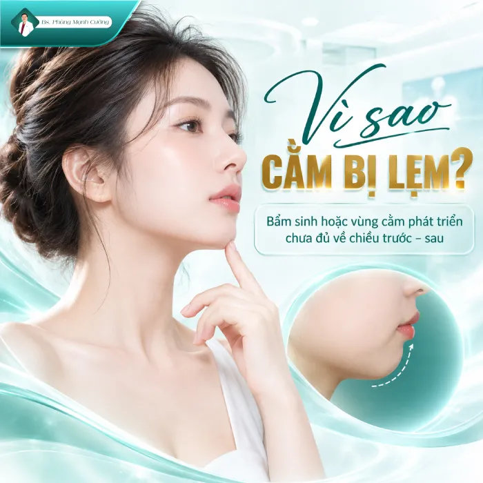 Độn Cằm Lẹm: Nguyên Nhân, Phương Pháp Khắc Phục Và Những Điều Cần Biết