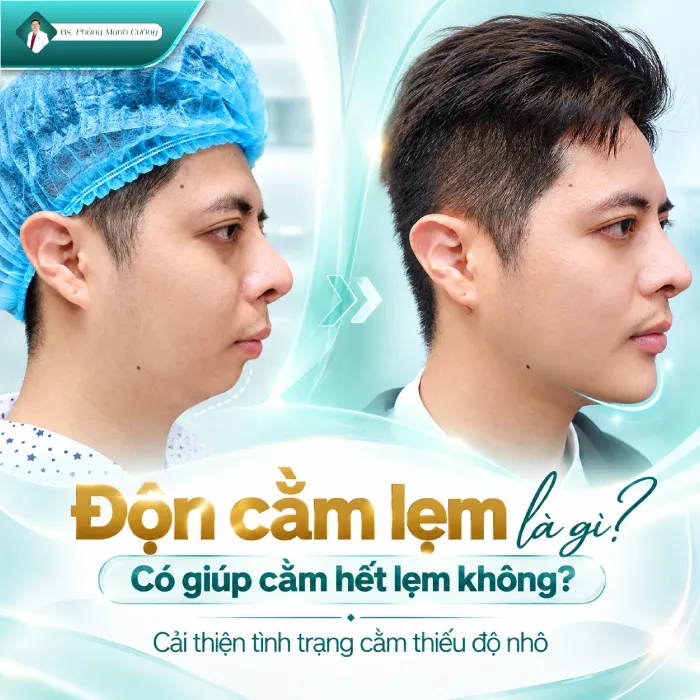Độn Cằm Lẹm: Nguyên Nhân, Phương Pháp Khắc Phục Và Những Điều Cần Biết