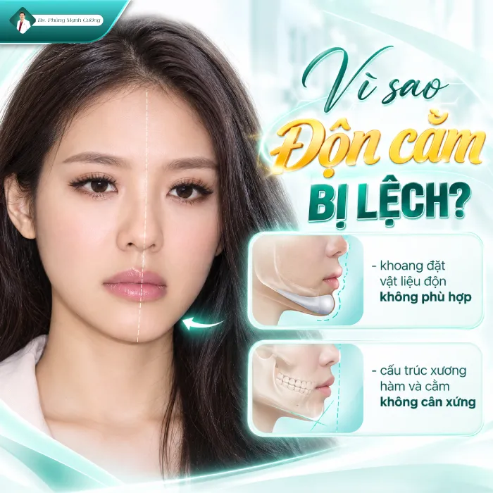 Độn Cằm Bị Lệch Phải Làm Sao? Nguyên Nhân Và Cách Khắc Phục
