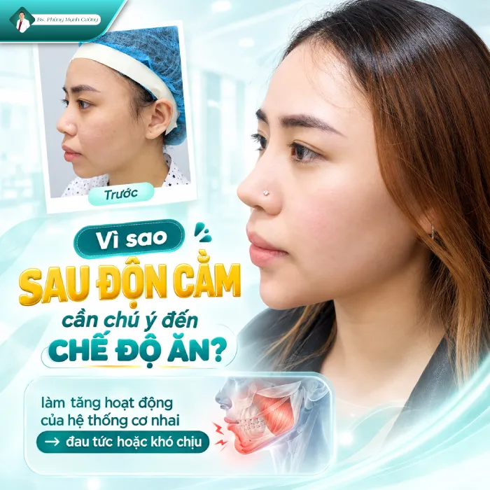 Độn Cằm Kiêng Ăn Gì? Bác Sĩ Phùng Mạnh Cường Giải Đáp Chi Tiết