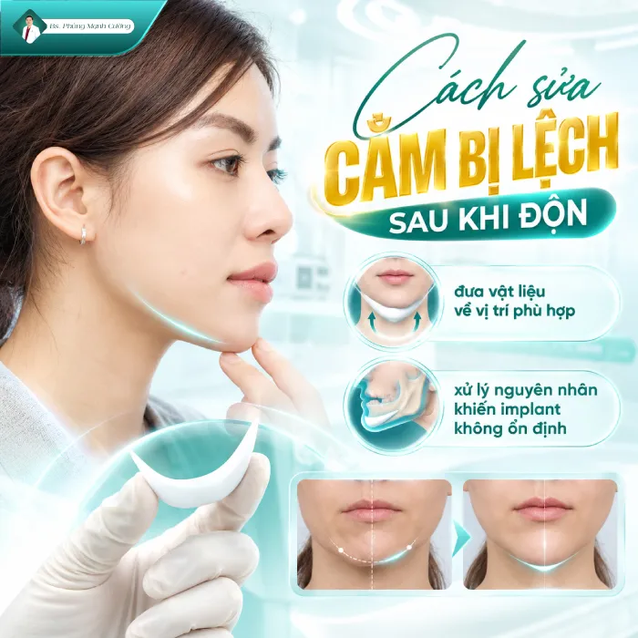 Độn Cằm Bị Lệch Phải Làm Sao? Nguyên Nhân Và Cách Khắc Phục