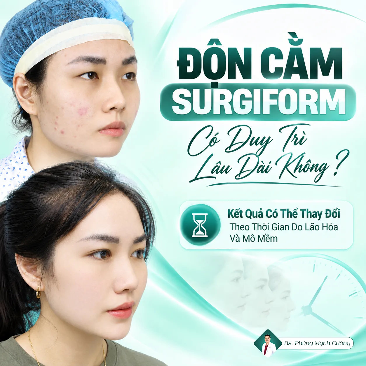 Độn Cằm Sụn Surgiform: Bác Sĩ Phùng Mạnh Cường Chia Sẻ Những Điều Cần Biết