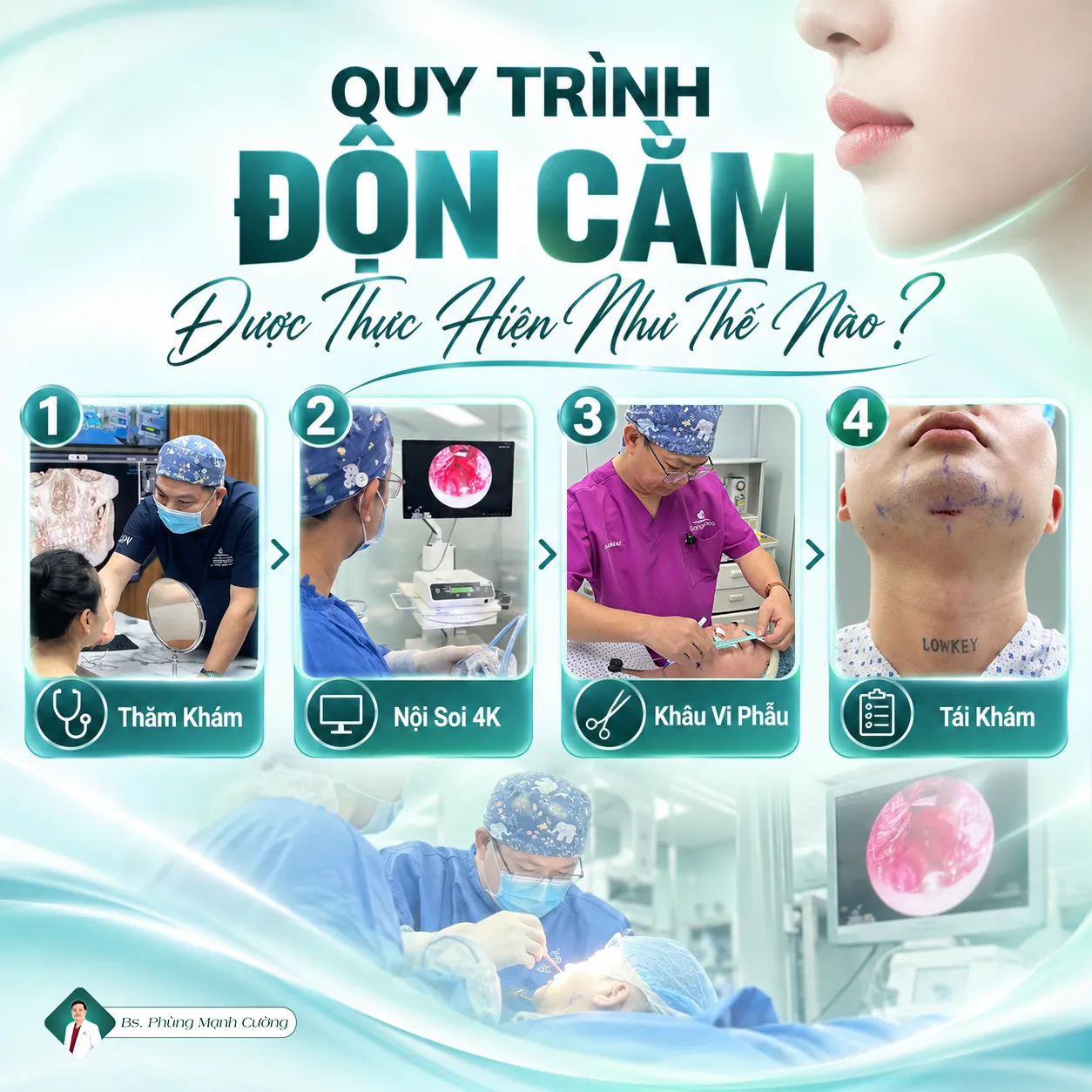Độn Cằm Sụn Surgiform: Bác Sĩ Phùng Mạnh Cường Chia Sẻ Những Điều Cần Biết